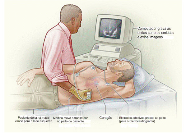 Exame ecocardiograma